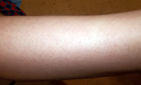 Toe Juice Review and Giveaway